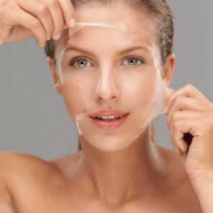 Medical Grade Chemical Peels