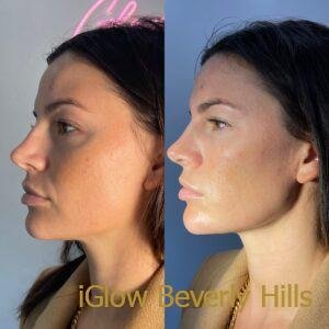 238368E3-A7F1-4347-826D-5DA005824CA2