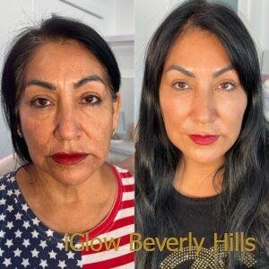 3C9596B3-5B2B-41C0-87D5-396780E54637